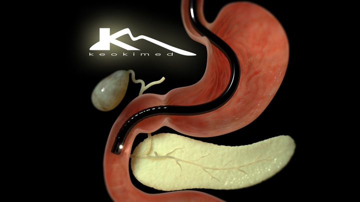 ERCP – Endoscopic Retrograde Cholangio-pancreatography – Keokimed